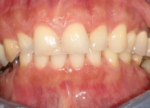 Before dentistry at Premier Dental Care