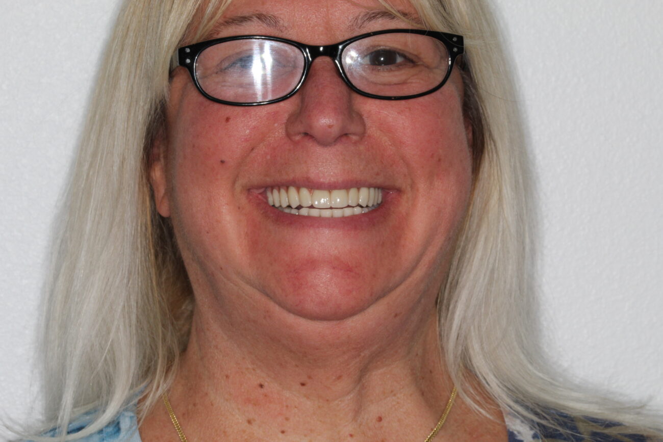 Dentistry results at Premier Dental Care