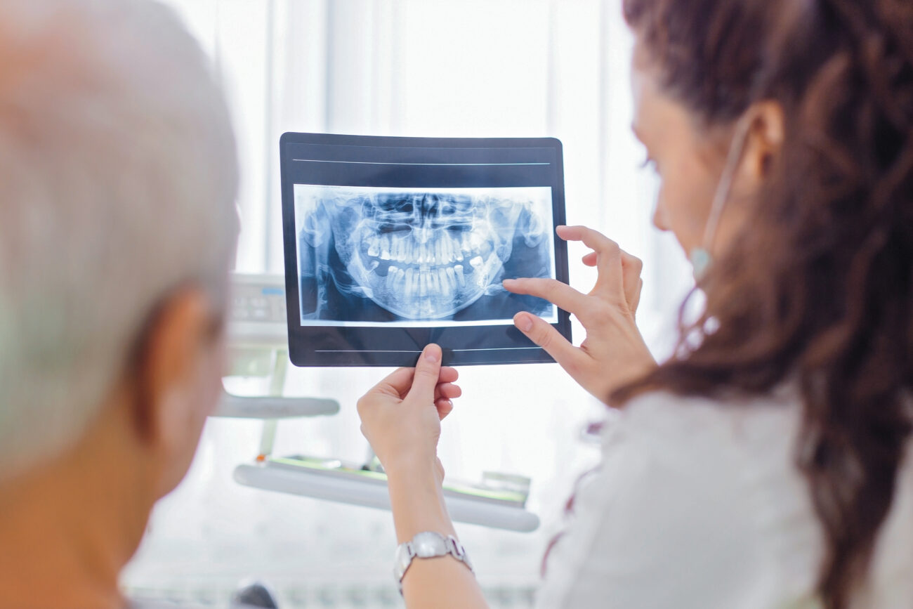 Bone Grafting in Palmdale, California