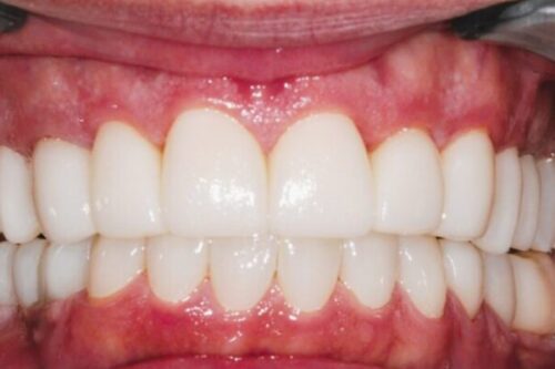 After dentistry at Premier Dental Care