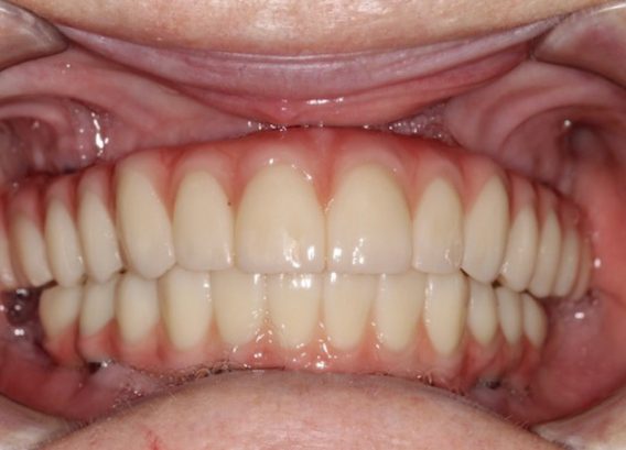 After dentistry at Premier Dental Care