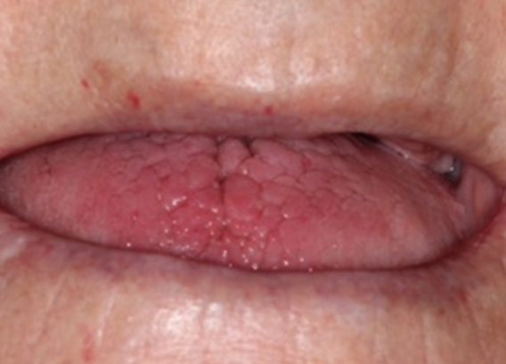 Before dentistry at Premier Dental Care