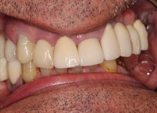 Before dentistry at Premier Dental Care