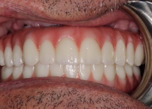 After dentistry at Premier Dental Care