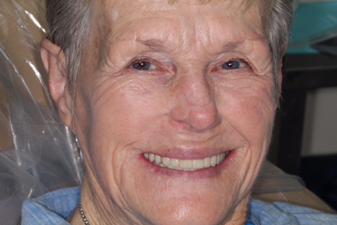 Dentistry results at Premier Dental Care