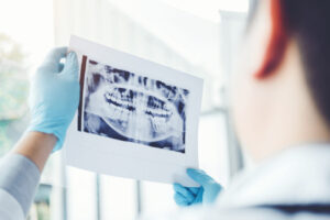Determining if you qualify for dental implants involves assessing various factors, such as gum health and bone density.