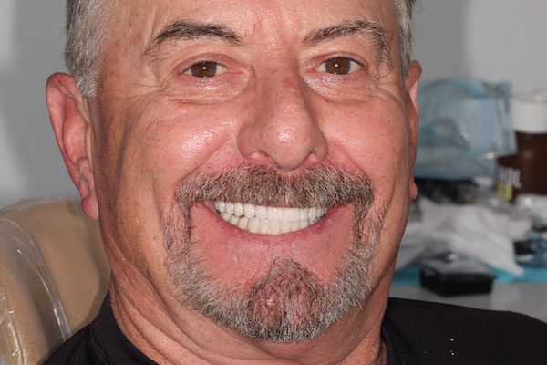 Dentistry results at Premier Dental Care