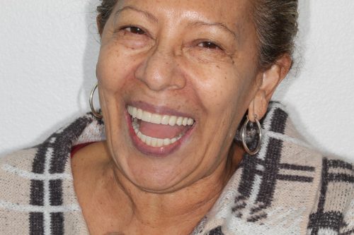 Dentistry results at Premier Dental Care