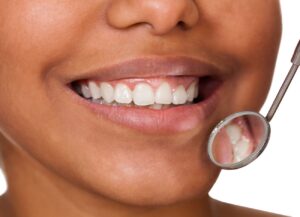 Stages of Gum Disease