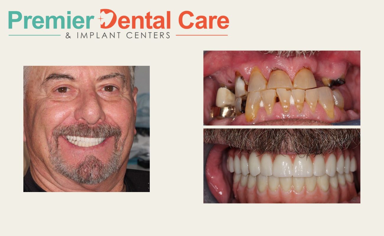 Happy patient after getting dental implants at Premier Dental Care.