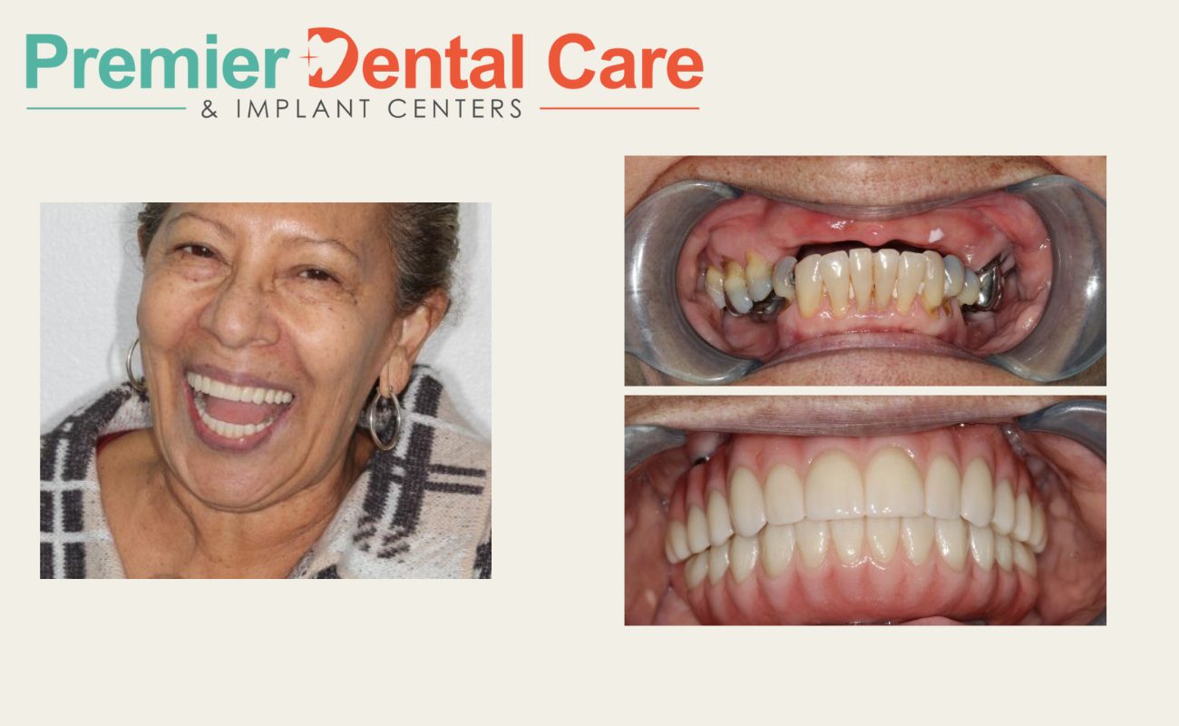 Happy patient after replacing missing teeth with implants at Premier Dental Care.