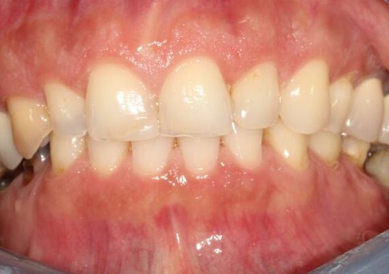 1ggCp43M-scaled-e1675094174634-568x400